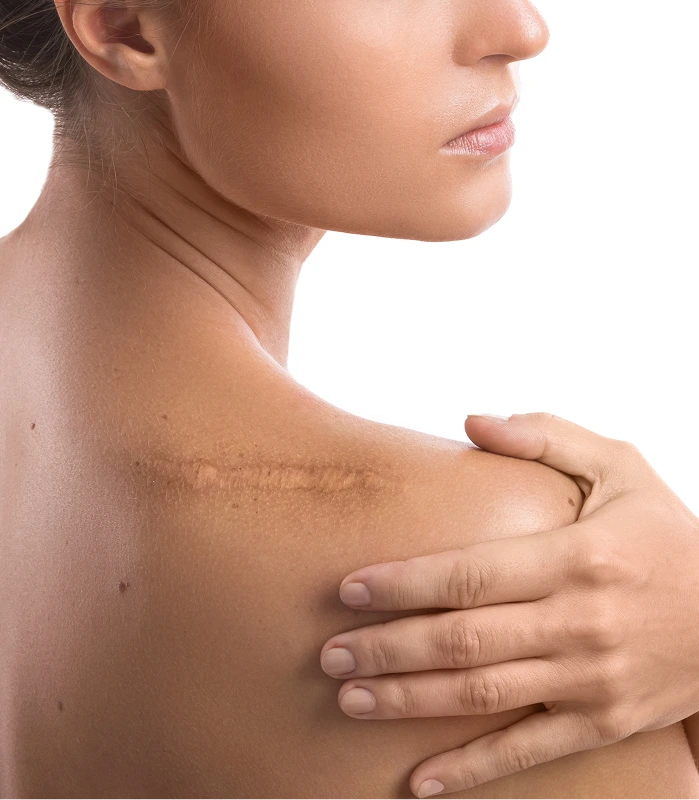 Woman's shoulder and neck shown in profile, displaying skin texture and complexion